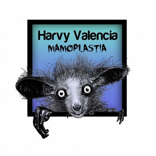 Mamoplastia