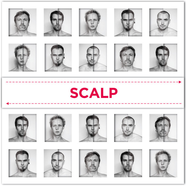Victims Of Hate/Scalp