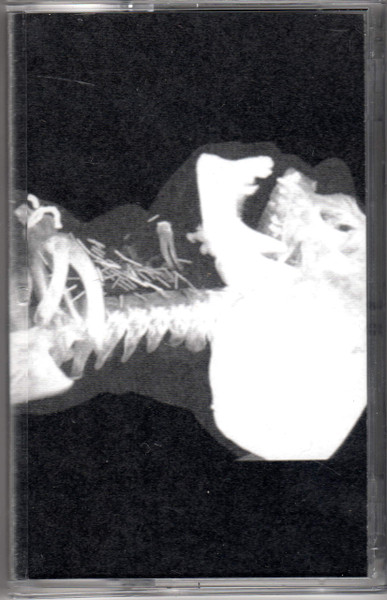 The Neck Cracker