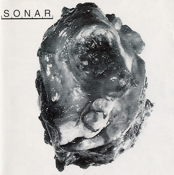 Sonar