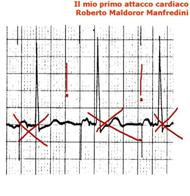 Il Mio Primo Attacco Cardiaco