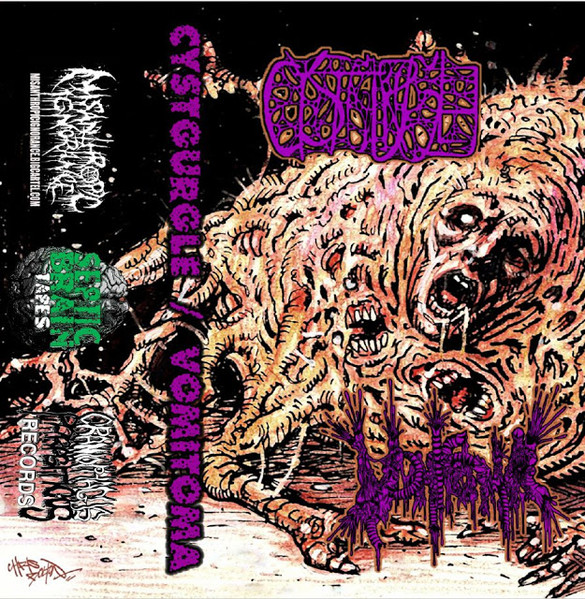 Biotoxic Emetoentomological Enterocholecystomy / Vomitoma