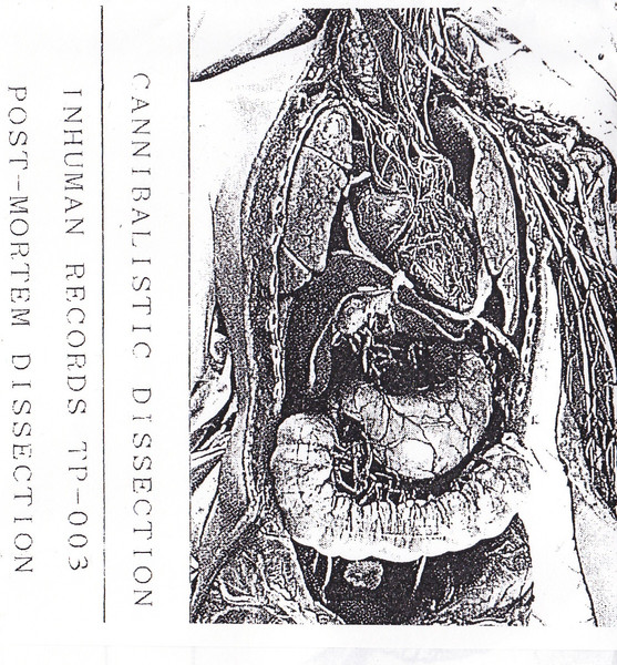Post-mortem Dissection