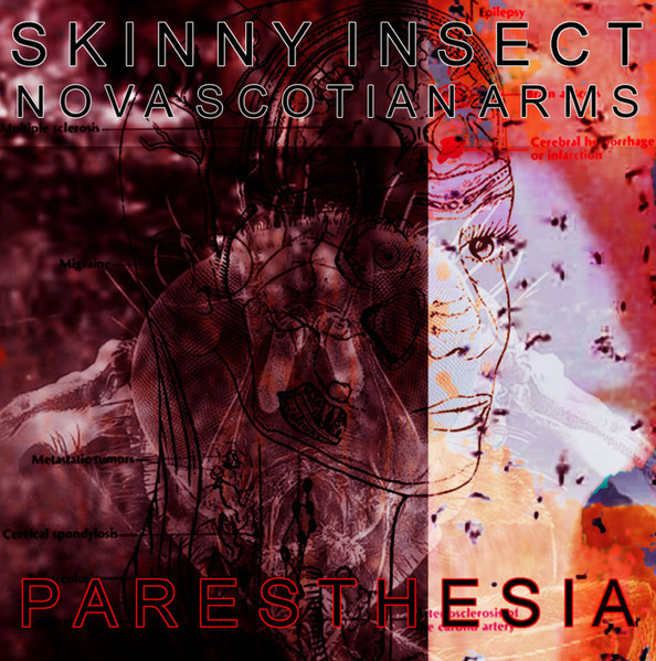 Parethesia