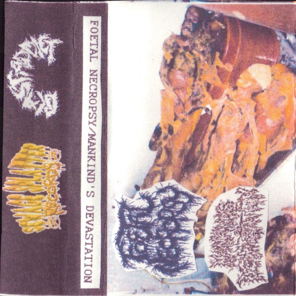 Foetal Necropsy/Mankind's Devastation Split