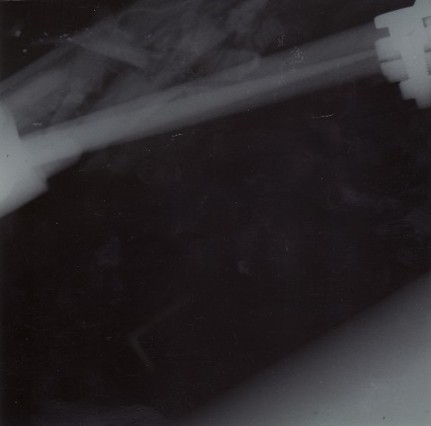 X-Ray