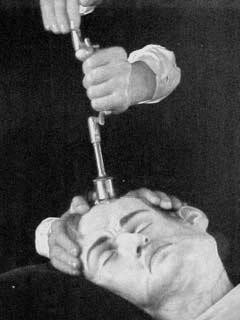 The Third Eye Is A Hole In The Head