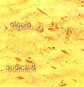 Audiotbit