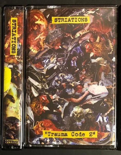 Trauma Code 2