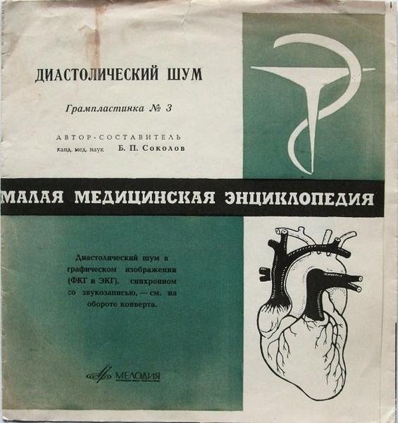 Диастолический Шум