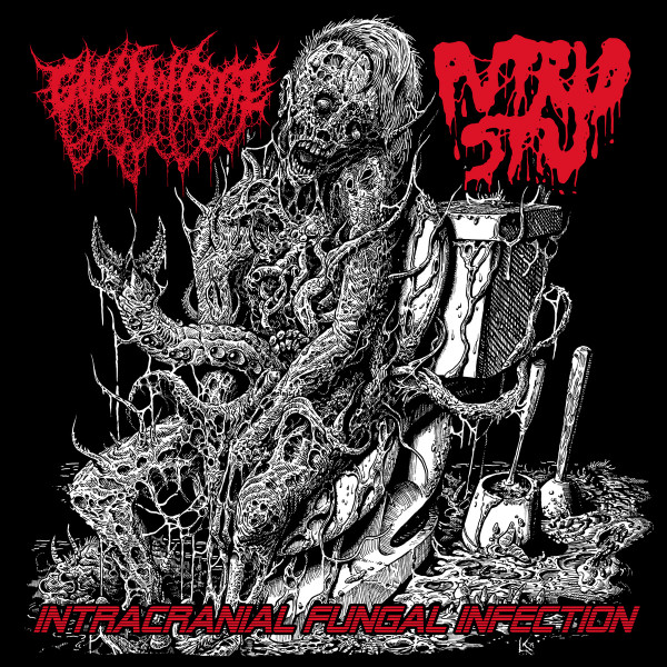 Intracranial Fungal Infection