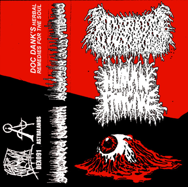 Coagulative Necrosis / Human Pancake