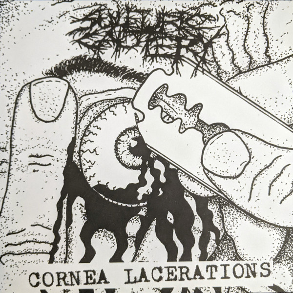 Cornea Lacerations