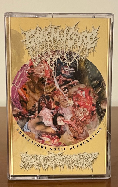 Ambulatory Sonic Suppuration