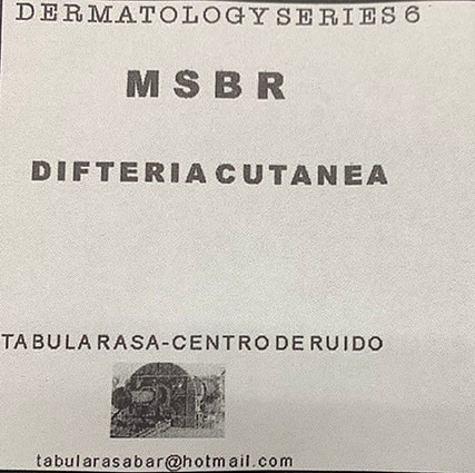 Difteria Cutanea