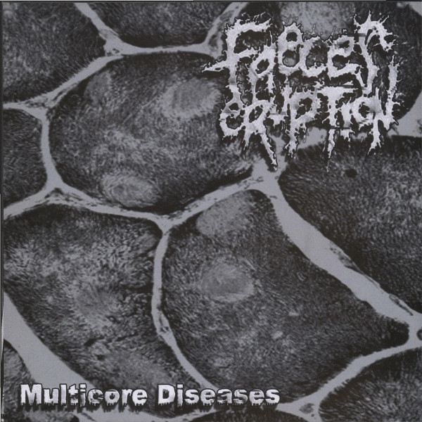 Multicore Diseases / Off-Toilet Ecstasies