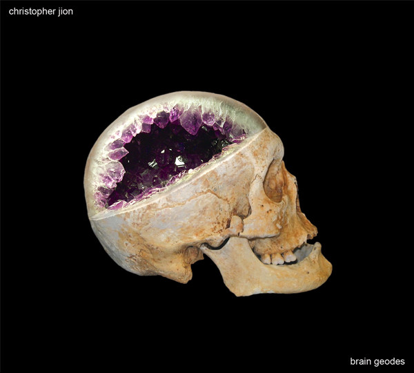 Brain Geodes