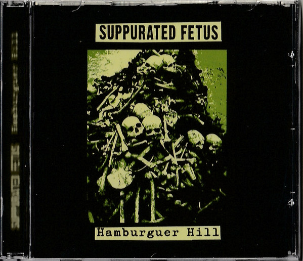 Hamburguer Hill
