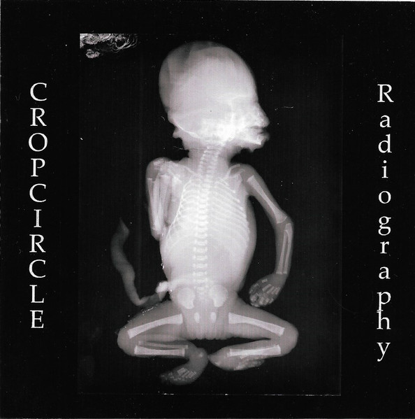 Radiography