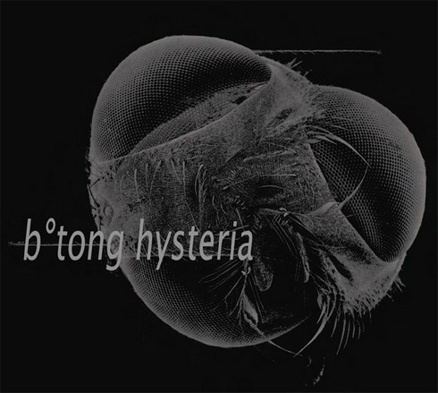 Hysteria