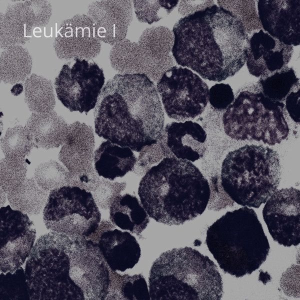 Leukämie I 