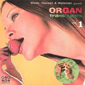 Organ Transplants Vol. 1