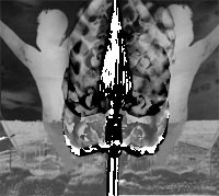 Corpus Callosum / Legless