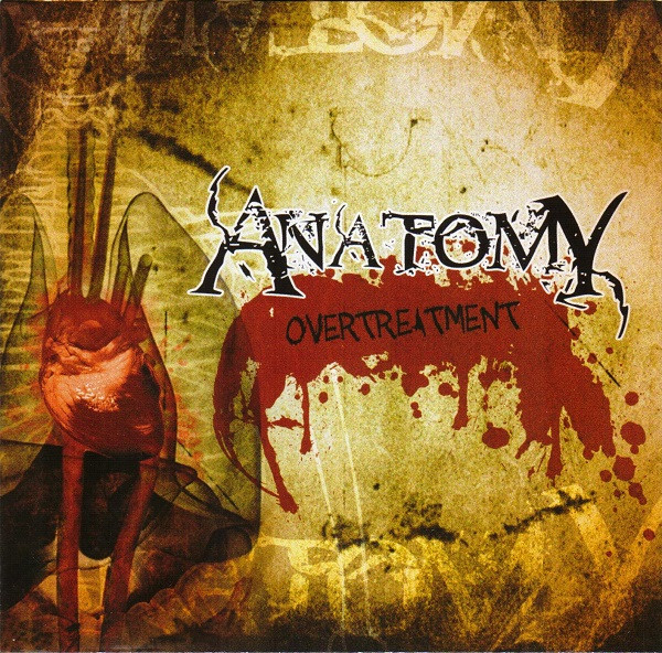 Overtreatment