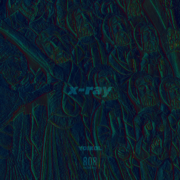 X-Ray