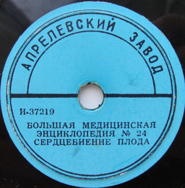 Сердцебиение Плода