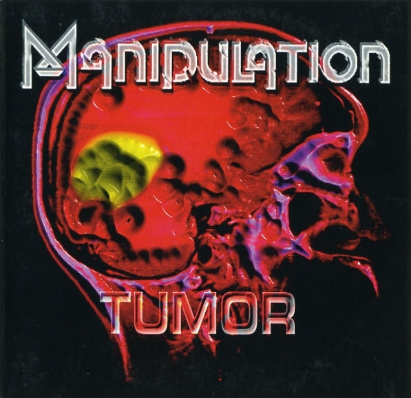Tumor