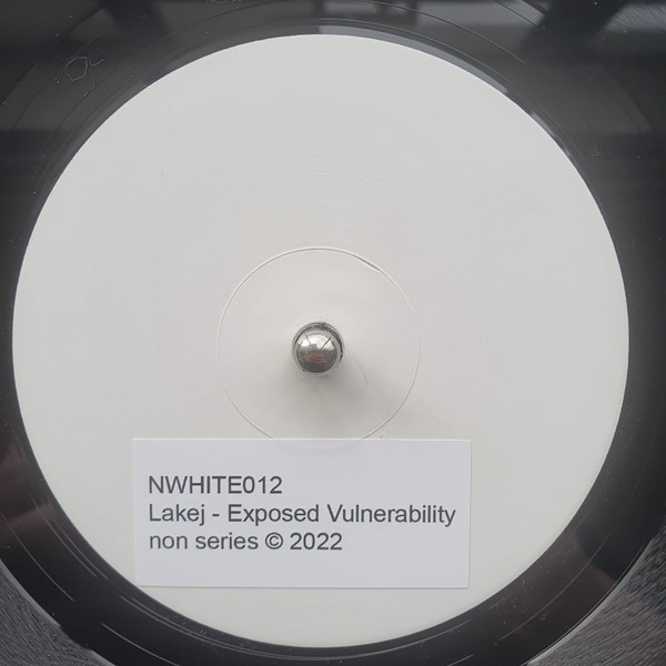 Exposed Vulnerability