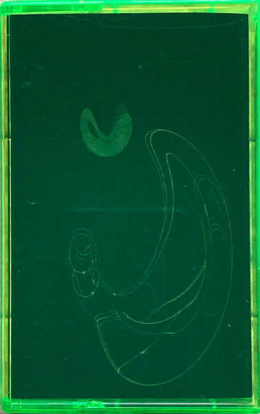 Klein Bottles