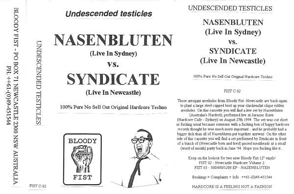 Undescended Testicles