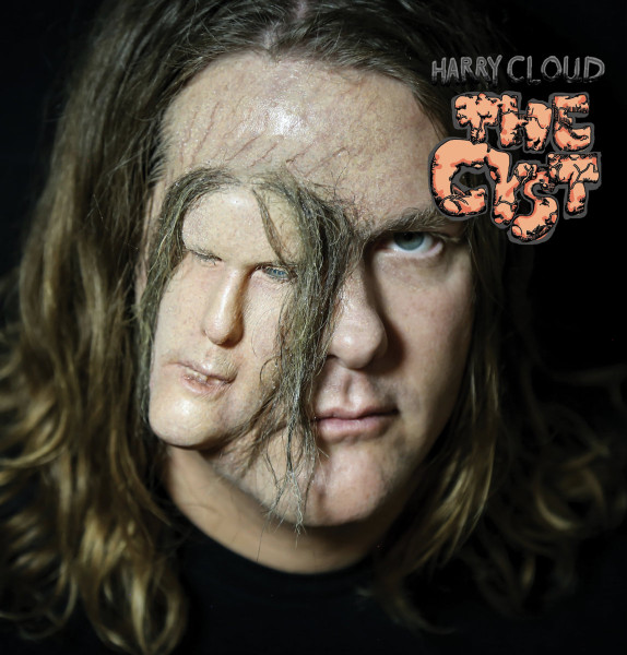 The Cyst