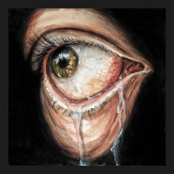Lacrimal