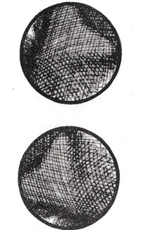 Split