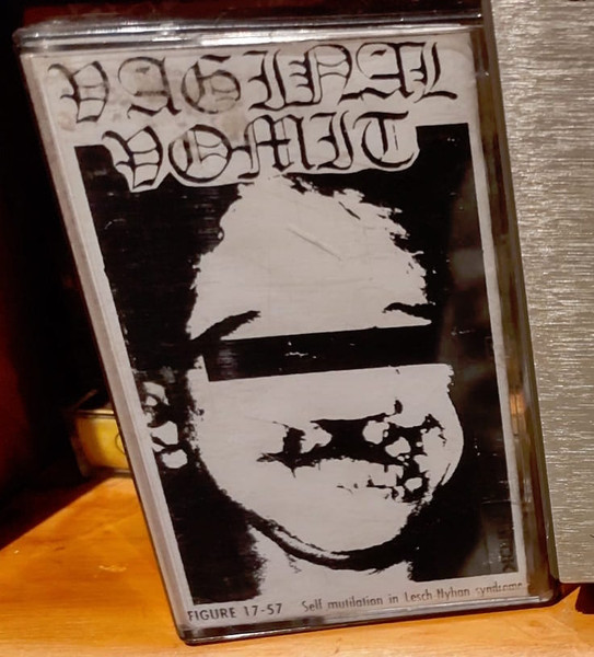 "Vaginal Vomit" Zine & Compilation Tapes Vol.#3