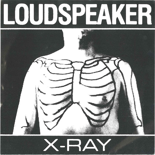 X-Ray