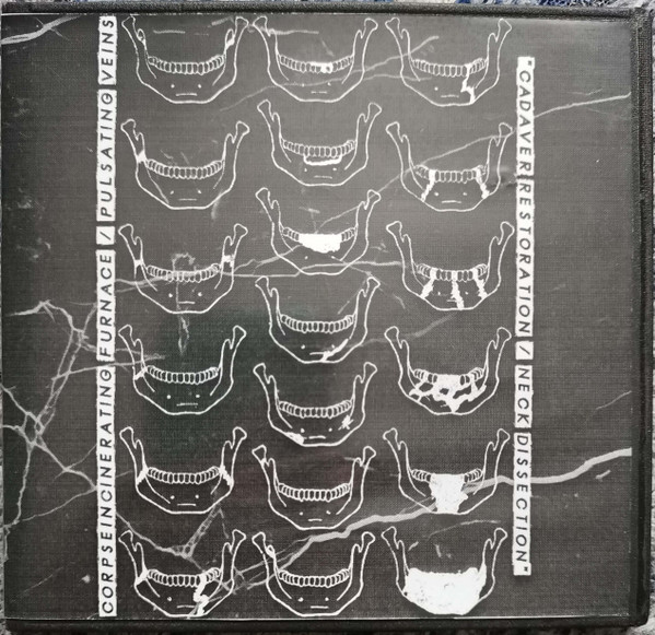 Cadaver Restoration / Neck Dissection