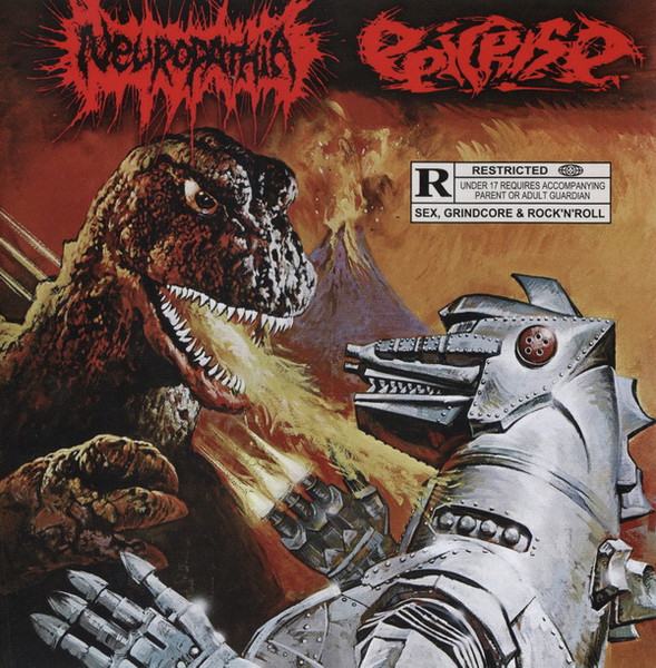 Neuropathia / Epicrise