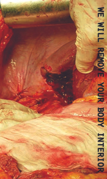 We Will Remove Your Body Interior