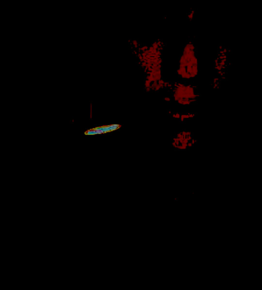 BCJ​(​94