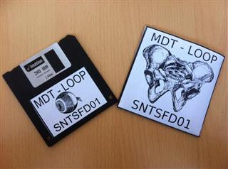 Loop