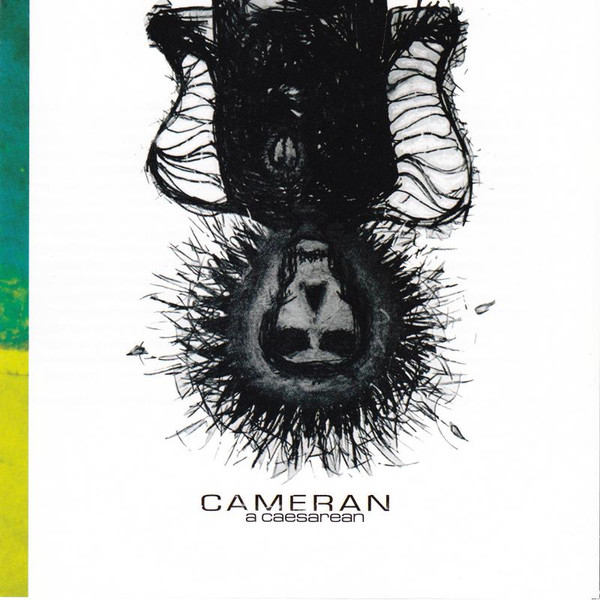 A Caesarean