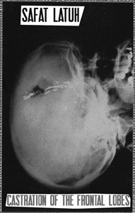Castration Of The Frontal Lobes