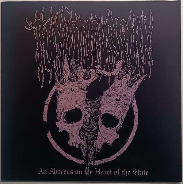 An Abscess On The Heart Of The State