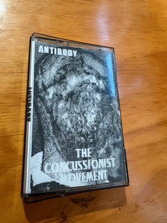 The Concussionist Movement