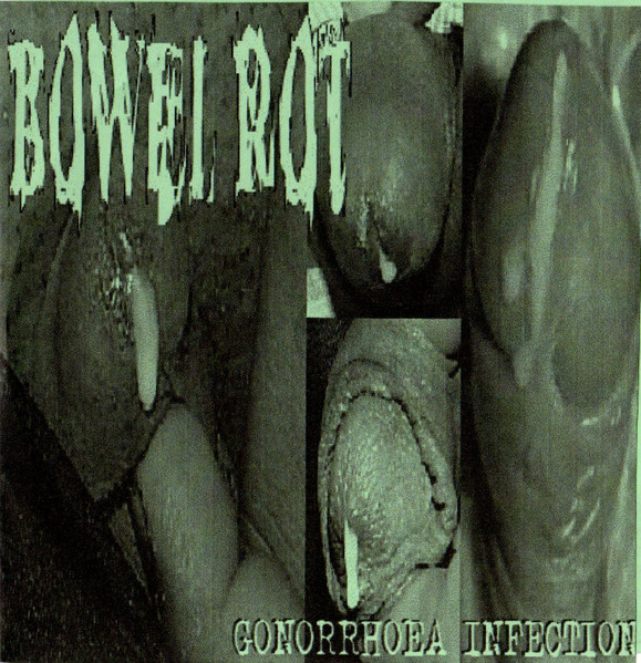 Gonorrhoea Infection