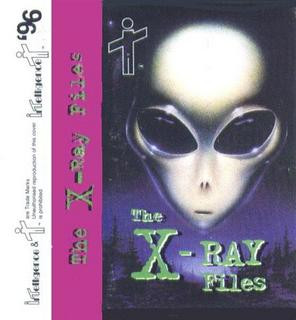 The X Ray Files